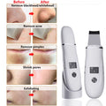 Ultrasonic Skin Scrubber Blackhead Remover Ultrasonic Facial Peeling Scrubber Acne Pore Removal Shovel Deep Cleaning EMS Lifting