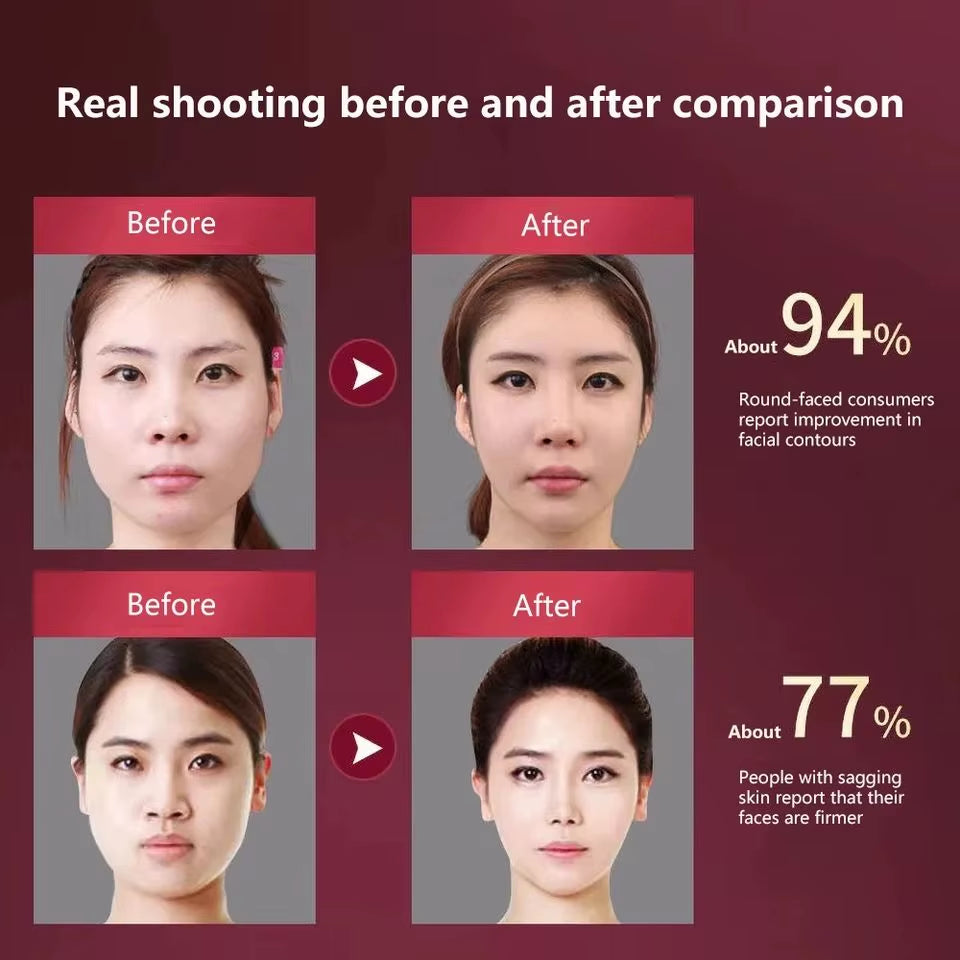 SlimLift LED Facial Massager